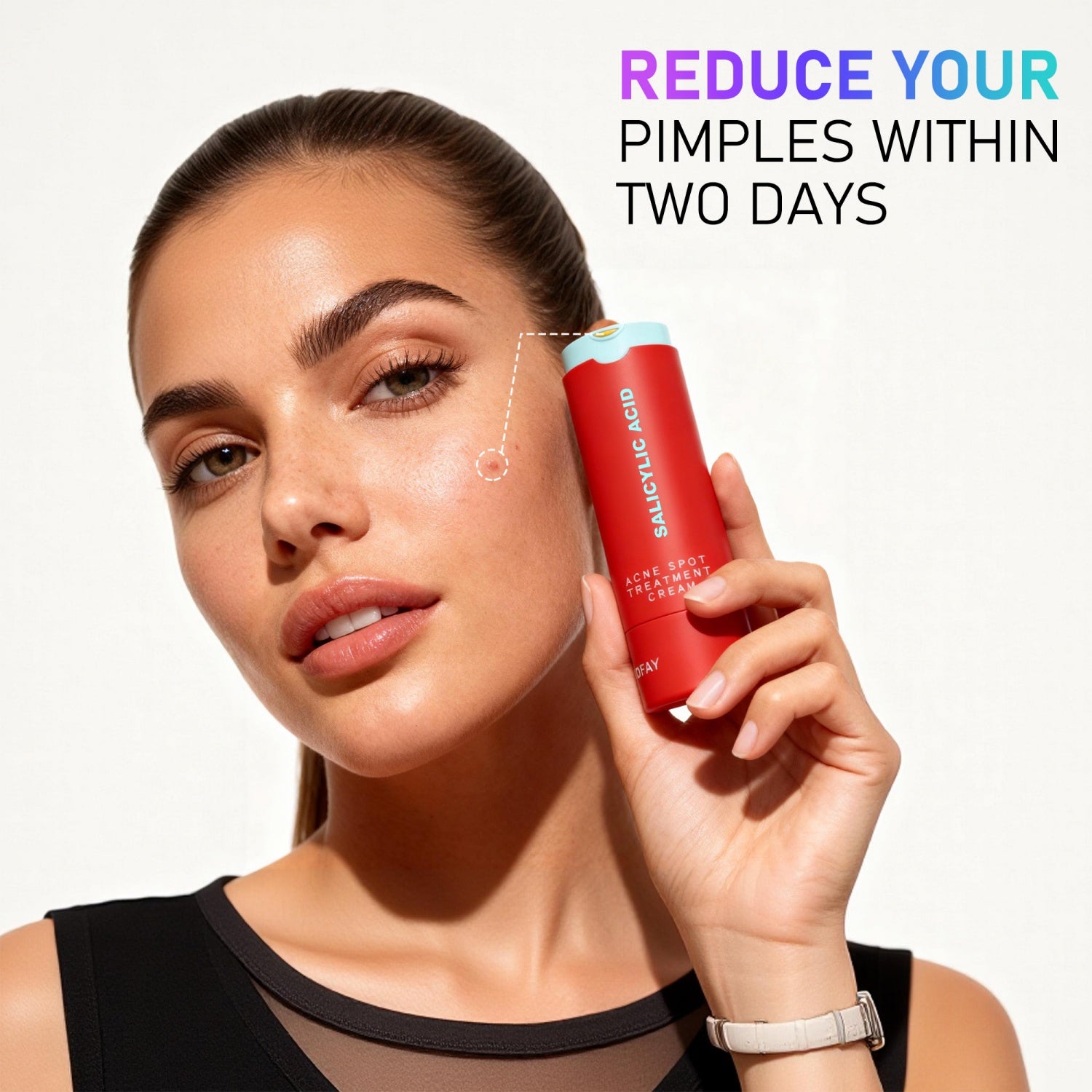 Acne Removing Lotion – Lightweight Anti-Blemish Treatment