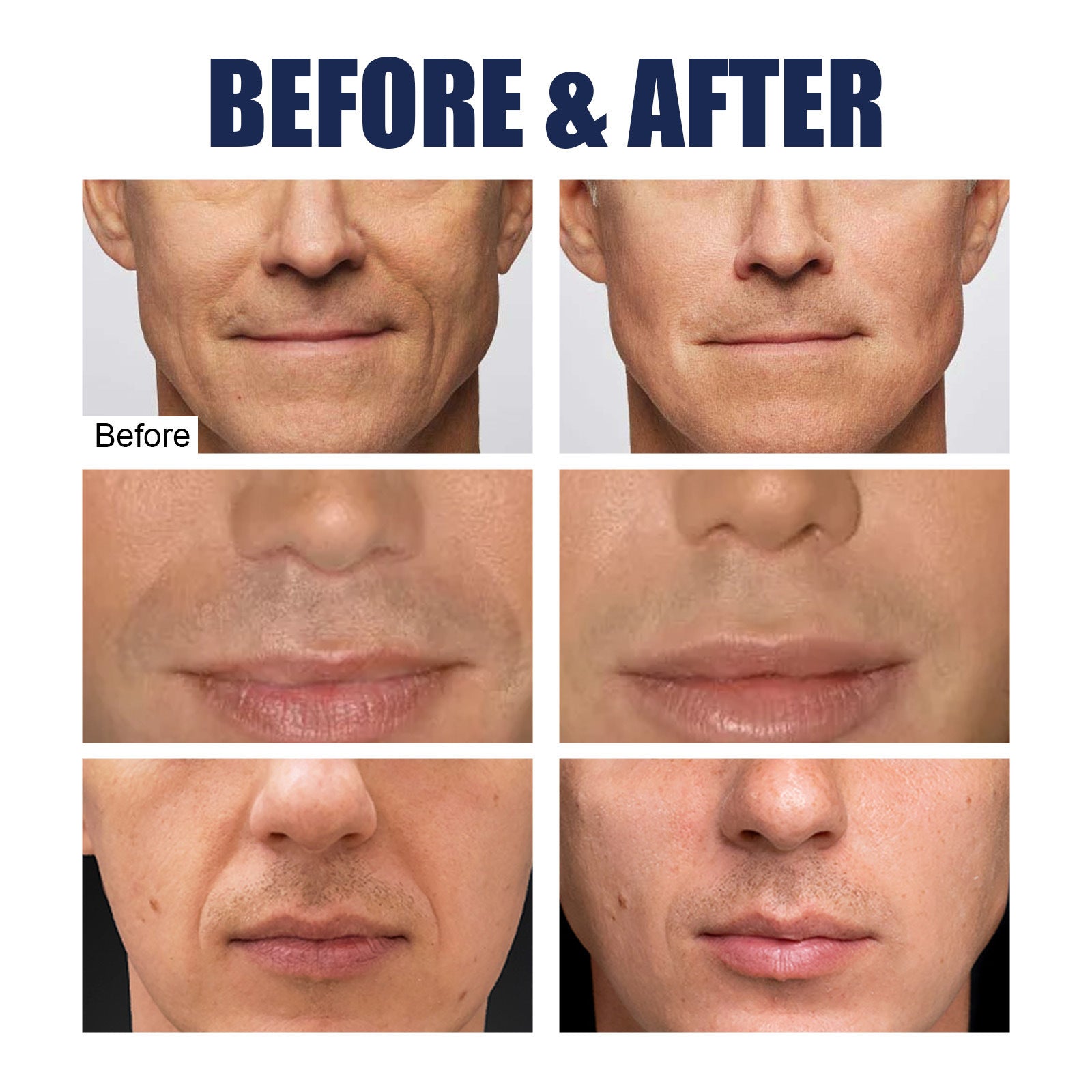 Men's Anti-wrinkle Mask Smoothing And Firming