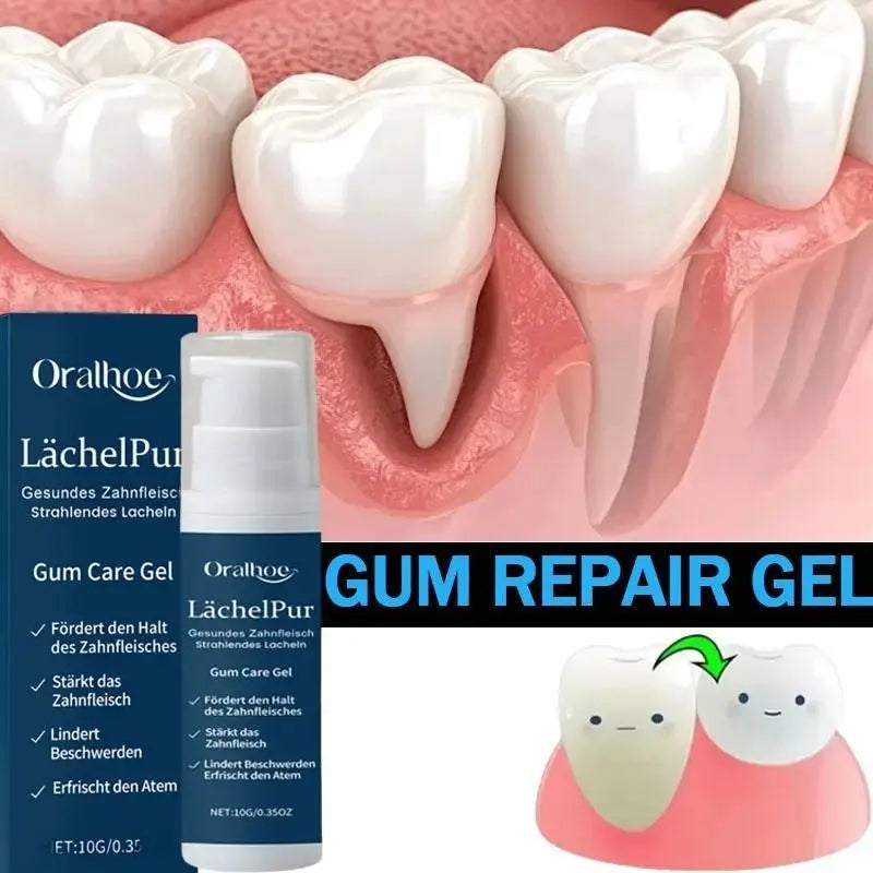Gel de reparación rápida de encías, alivia eficazmente la alergia dental, caries, limpieza dental, pasta de dientes, alivia el suero de daños en los dientes
