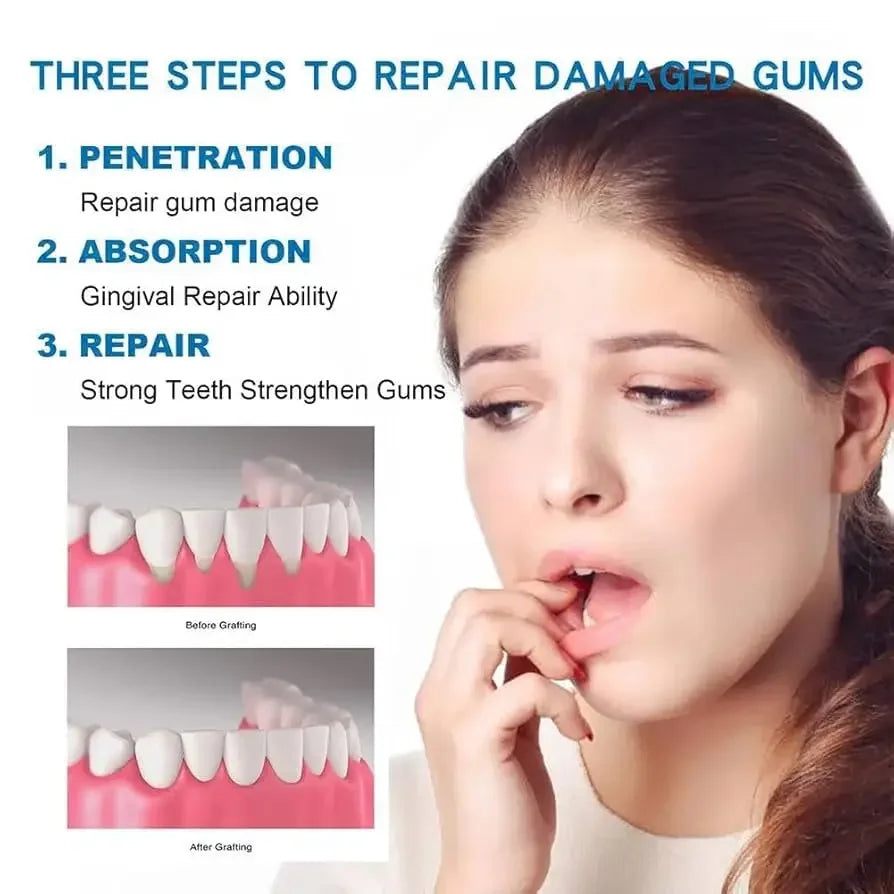 Gel de reparación rápida de encías, alivia eficazmente la alergia dental, caries, limpieza dental, pasta de dientes, alivia el suero de daños en los dientes