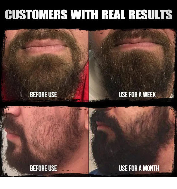 Beard Oil Mild Nourishing Beard Essential Oil 30ml - Bellarte Enchanté Beard Oil Mild Nourishing Beard Essential Oil 30ml