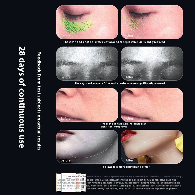 Beauty Instrument Household Color Light EMS Lifting Skin Rejuvenation Massage Cleaning 6-in-1 - Bellarte Enchanté Beauty Instrument Household Color Light EMS Lifting Skin Rejuvenation Massage Cleaning 6-in-1