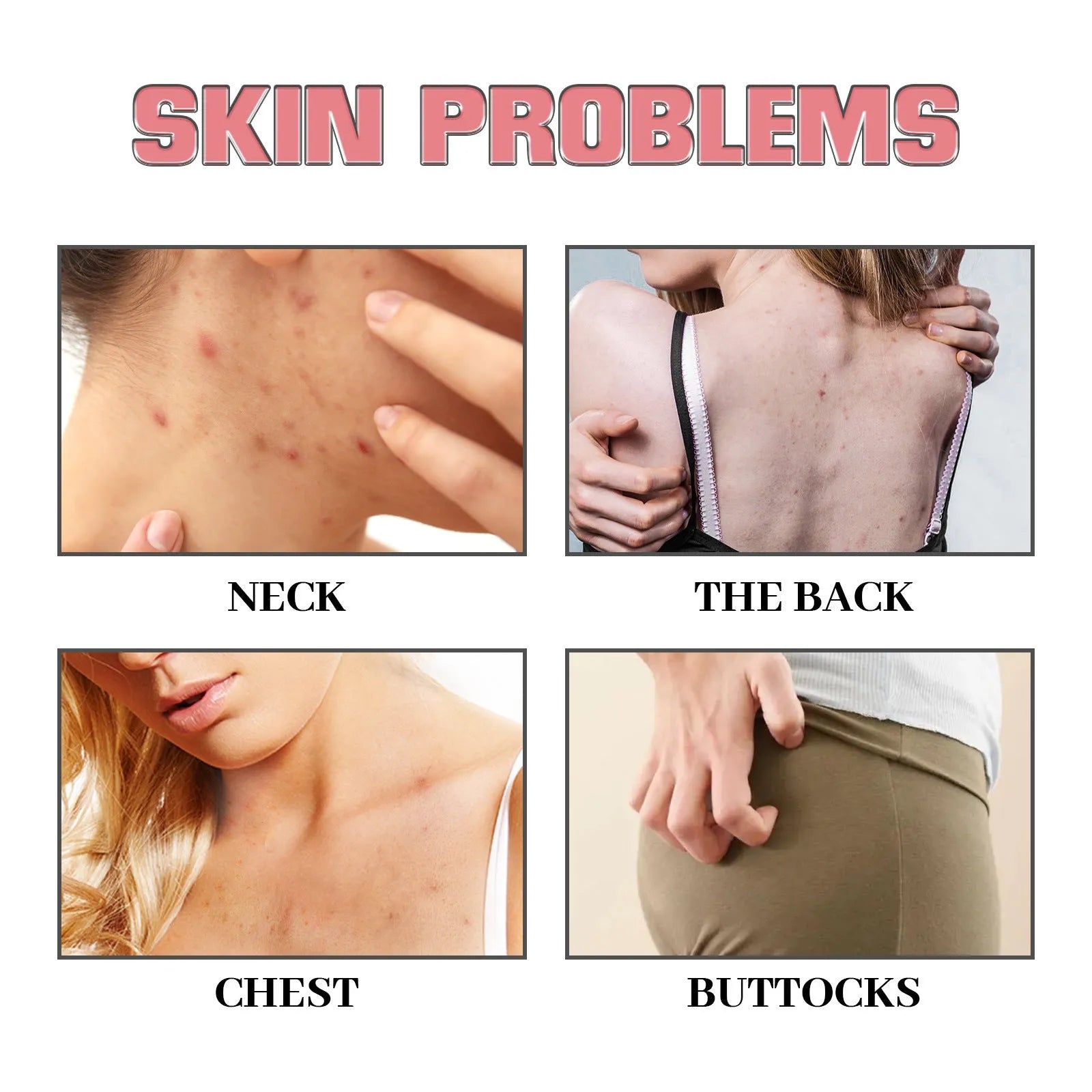 Exfoliating Bath Soap Smallpox Diluting - Bellarte Enchanté Exfoliating Bath Soap Smallpox Diluting