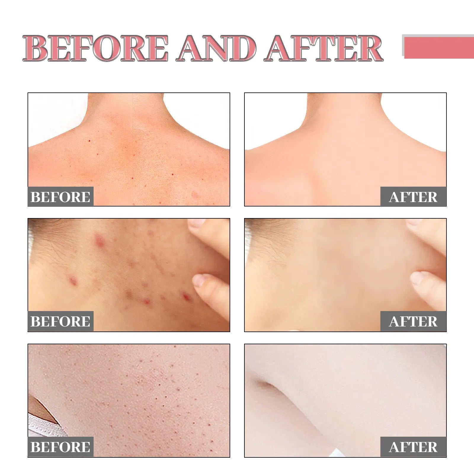 Exfoliating Bath Soap Smallpox Diluting - Bellarte Enchanté Exfoliating Bath Soap Smallpox Diluting