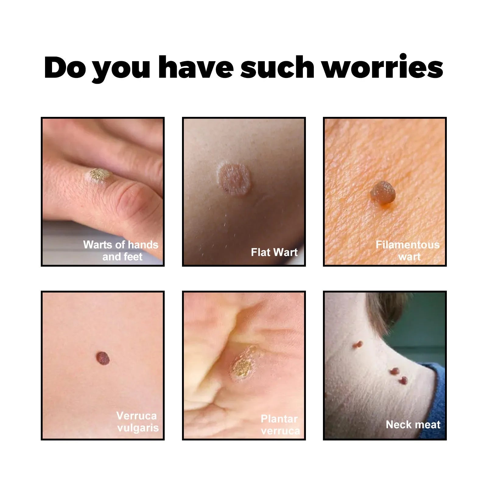 Facial Neck Body Skin Cleaning Care Wart Soap - Bellarte Enchanté Facial Neck Body Skin Cleaning Care Wart Soap