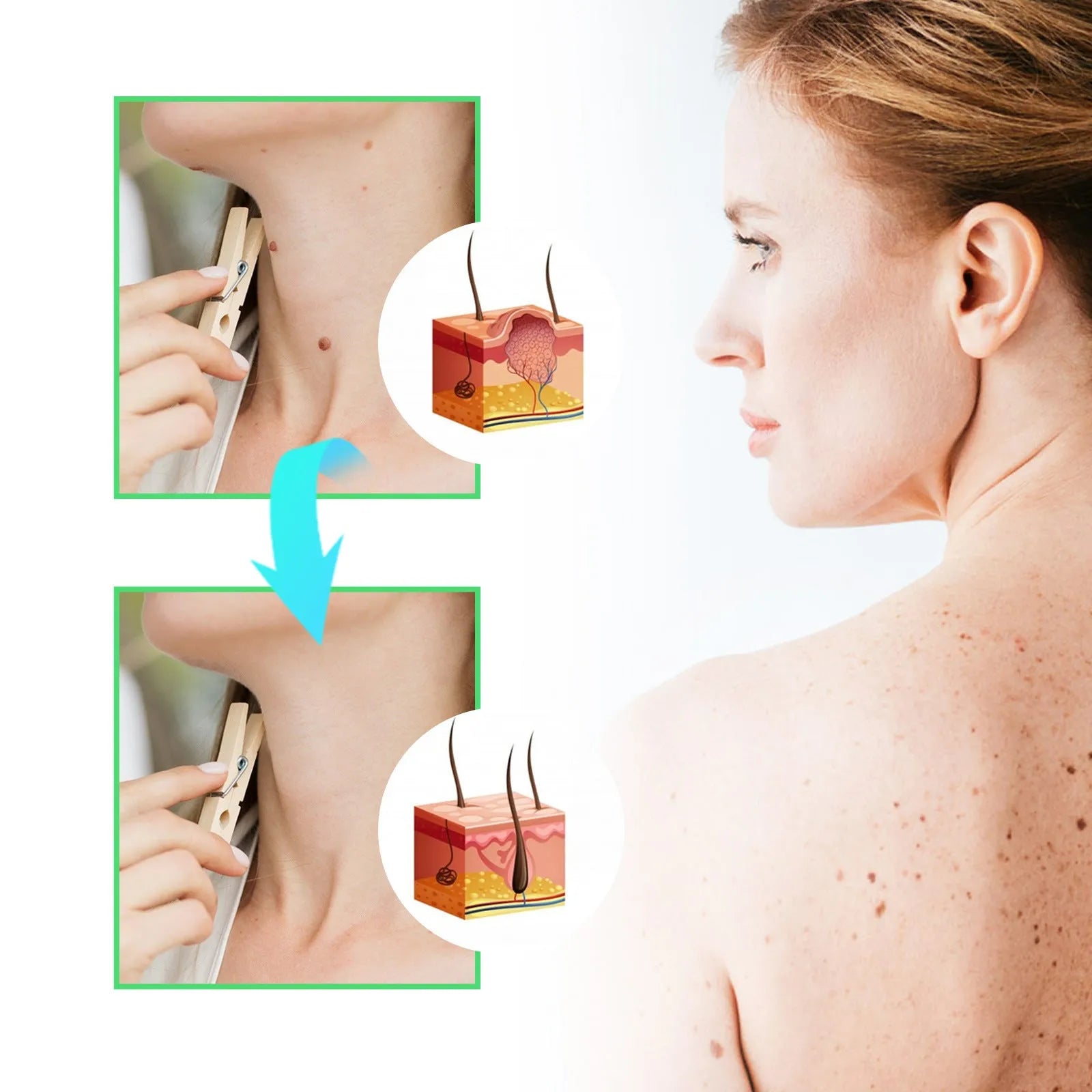 Facial Neck Body Skin Cleaning Care Wart Soap - Bellarte Enchanté Facial Neck Body Skin Cleaning Care Wart Soap