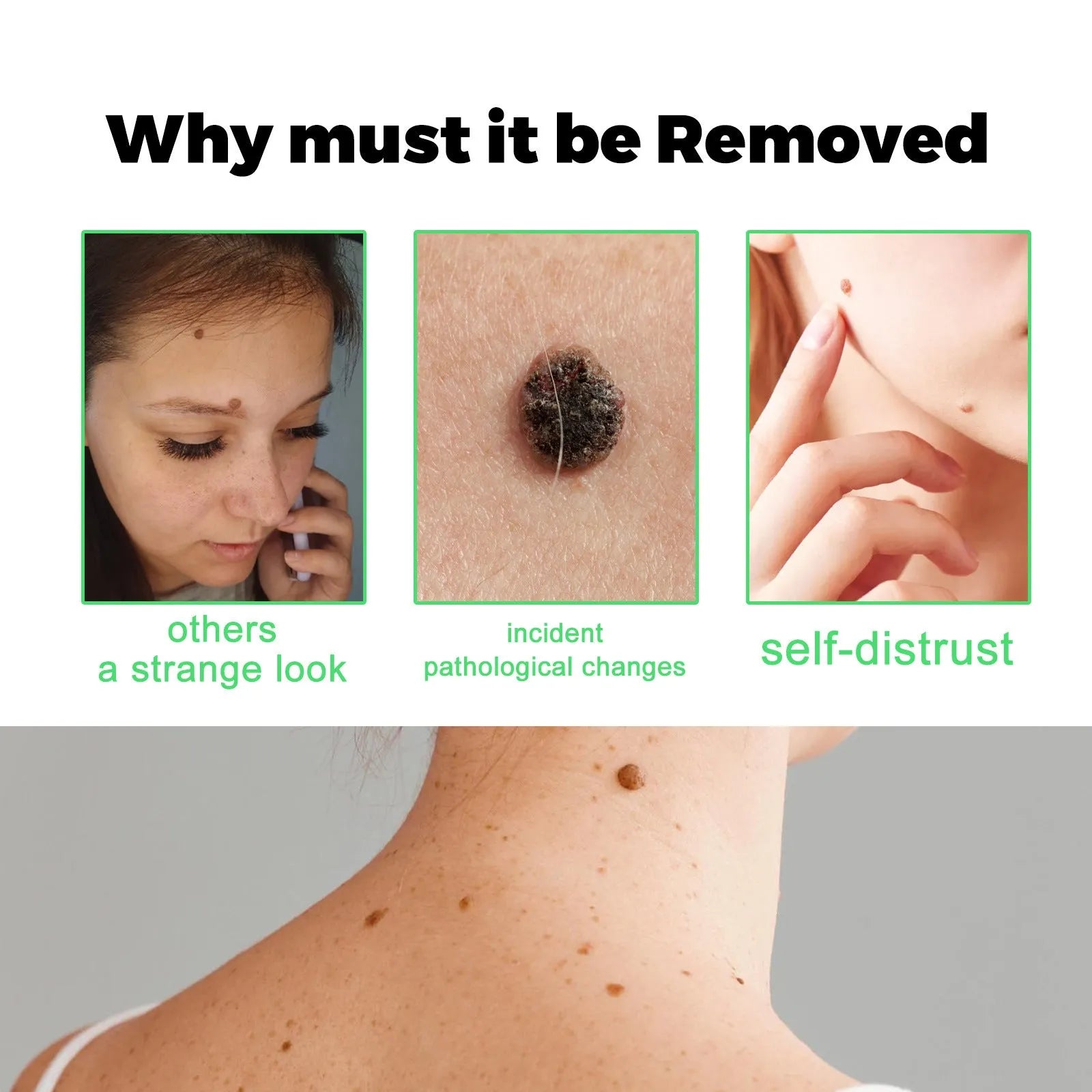 Facial Neck Body Skin Cleaning Care Wart Soap - Bellarte Enchanté Facial Neck Body Skin Cleaning Care Wart Soap