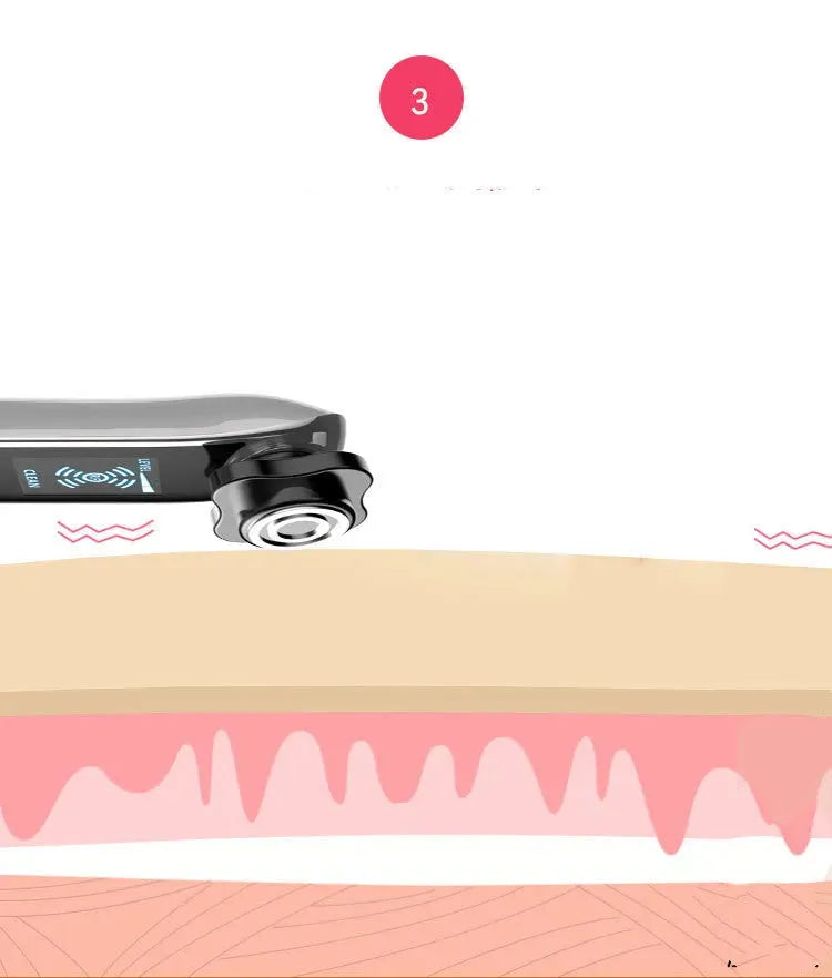 Facial Radio Frequency Beauty Lift And Tighten Face - Bellarte Enchanté Facial Radio Frequency Beauty Lift And Tighten Face