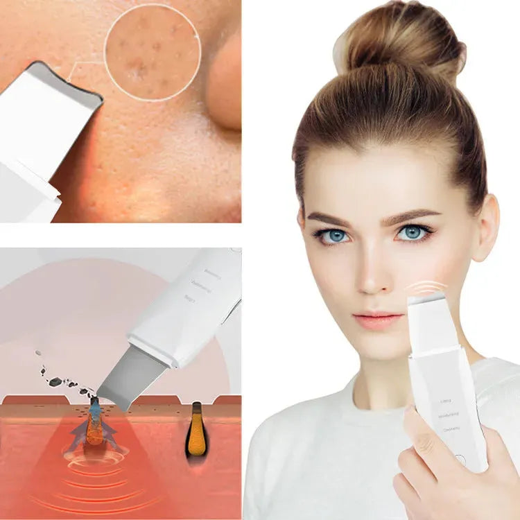 Massage Vibration Shoveling Machine Electric Peeling Machine - Bellarte Enchanté Massage Vibration Shoveling Machine Electric Peeling Machine