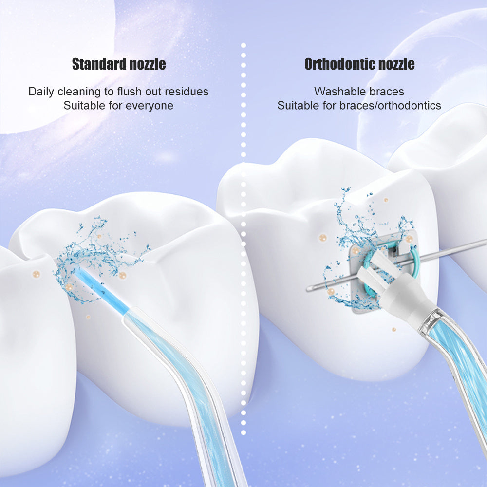 Oral Cleaning Electric Portable Tooth Scaler - Bellarte Enchanté Oral Cleaning Electric Portable Tooth Scaler