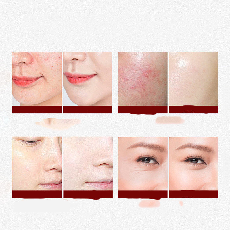 Photon Skin Rejuvenation 7-color Illumination Mask Apparatus - Bellarte Enchanté Photon Skin Rejuvenation 7-color Illumination Mask Apparatus