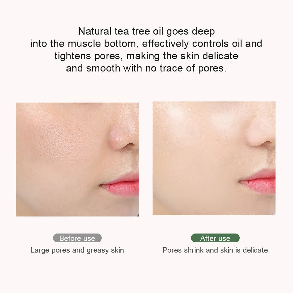 Pore Refinement Gel Pore Shrinkage - Bellarte Enchanté Pore Refinement Gel Pore Shrinkage