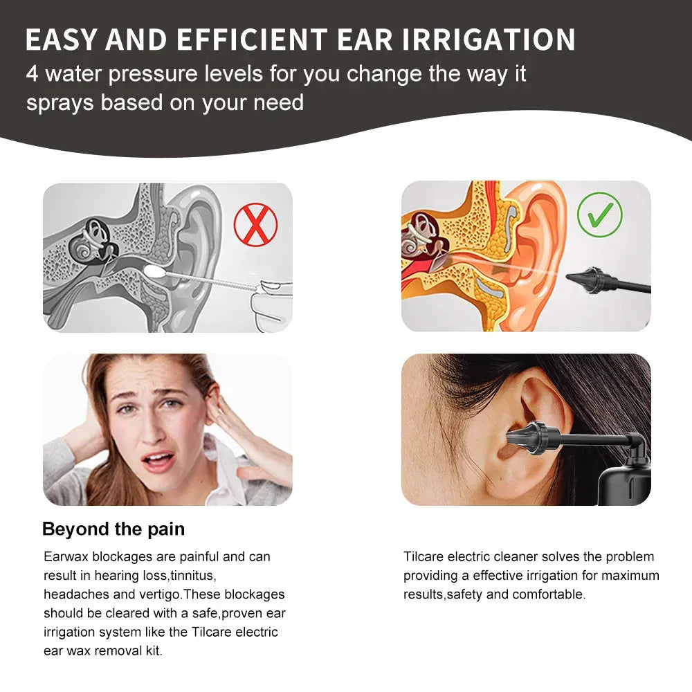 Three Types Of Nozzle Spray Earwax Accumulation Intelligent Ear Punch - Bellarte Enchanté Three Types Of Nozzle Spray Earwax Accumulation Intelligent Ear Punch