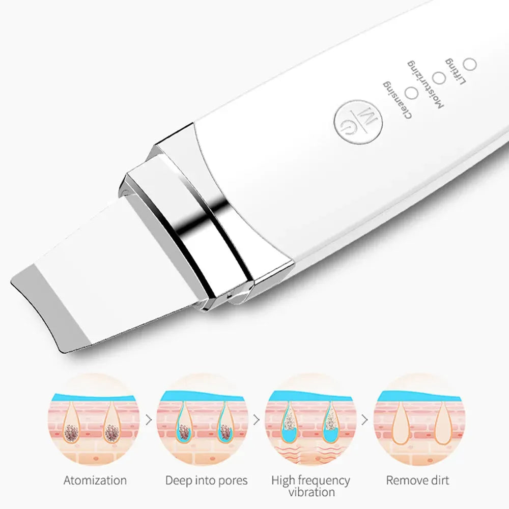 Ultrasonic Peeling Facial Cleanser - Bellarte Enchanté Ultrasonic Peeling Facial Cleanser