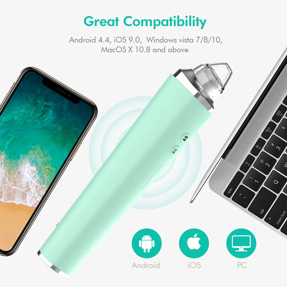 USB Rechargeable Vacuum Pimple Extractor Machine - Bellarte Enchanté USB Rechargeable Vacuum Pimple Extractor Machine
