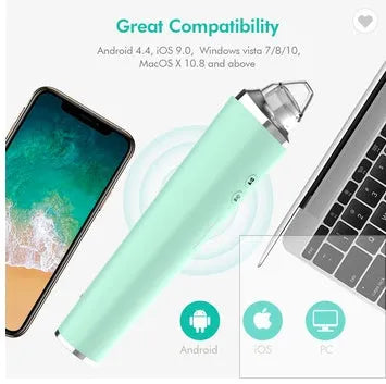 USB Rechargeable Vacuum Pimple Extractor Machine - Bellarte Enchanté USB Rechargeable Vacuum Pimple Extractor Machine